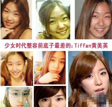 林允儿整容 女神整容前后像片对比 网友大喊坑爹